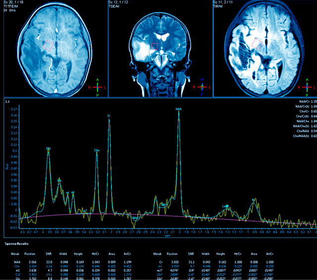 Slaap Workshop - Foto